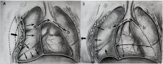 The Deadly Dozen The 12 Most Foreboding Chest Injuries Part I